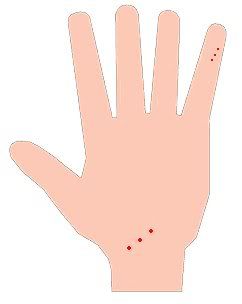 I have small pin prick like red dots all.
