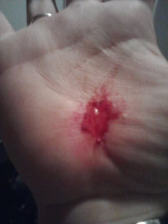 broke my fall