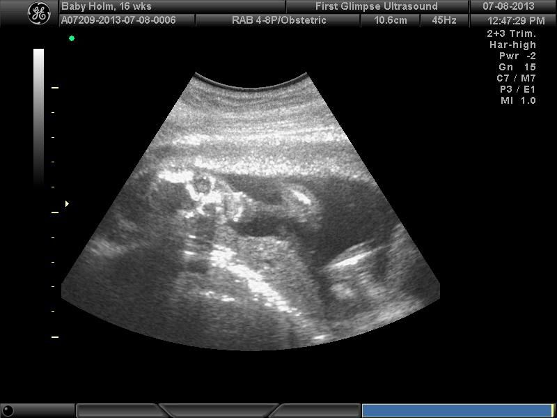 babbyb3-1.jpg